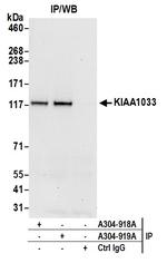 KIAA1033/WASH complex subunit 7 Polyclonal Antibody