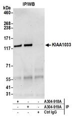 KIAA1033/WASH complex subunit 7 Antibody in Immunoprecipitation (IP)