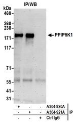 PPIP5K1/HISPPD2A Polyclonal Antibody