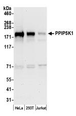 PPIP5K1/HISPPD2A Polyclonal Antibody