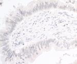 PIMT Polyclonal Antibody