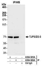 TJP3/ZO-3 Polyclonal Antibody