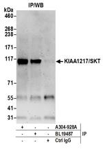 KIAA1217/SKT Antibody in Immunoprecipitation (IP)