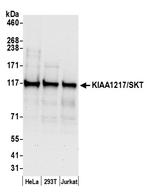 KIAA1217/SKT Polyclonal Antibody