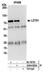 LZTS1 Antibody in Immunoprecipitation (IP)