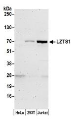 LZTS1 Polyclonal Antibody