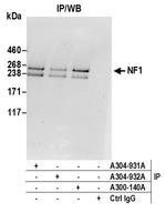 NF1 Antibody in Immunoprecipitation (IP)