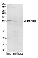 MAP7D3 Polyclonal Antibody