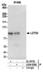LZTS2 Polyclonal Antibody