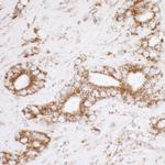 ATP5A1 Antibody in Immunohistochemistry (Paraffin) (IHC (P))