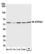 ATP5A1 Antibody in Western Blot (WB)