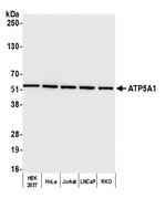 ATP5A1 Antibody in Western Blot (WB)