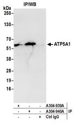 ATP5A1 Antibody in Immunoprecipitation (IP)