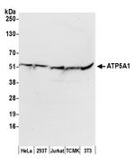ATP5A1 Antibody in Western Blot (WB)