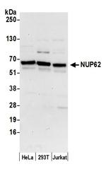Nucleoporin p62/NUP62 Polyclonal Antibody