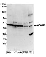 CDC123/C10orf7 Polyclonal Antibody