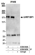 UHRF1BP1L/KIAA0701 Polyclonal Antibody