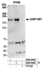 UHRF1BP1L/KIAA0701 Polyclonal Antibody