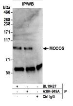 MOCOS Antibody in Immunoprecipitation (IP)