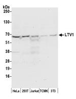 LTV1 Polyclonal Antibody