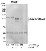 Codanin 1/CDAN1 Polyclonal Antibody