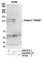 Codanin 1/CDAN1 Antibody in Immunoprecipitation (IP)