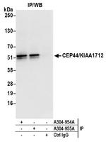 CEP44/KIAA1712 Polyclonal Antibody