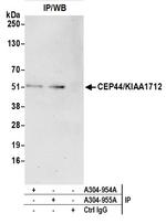 CEP44/KIAA1712 Antibody in Immunoprecipitation (IP)