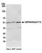 CEP44/KIAA1712 Antibody in Western Blot (WB)