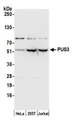 PUS3 Polyclonal Antibody