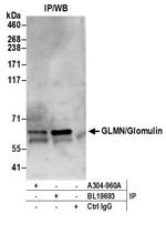 GLMN/Glomulin Antibody in Immunoprecipitation (IP)