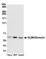 GLMN/Glomulin Polyclonal Antibody