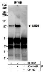NRD1/Nardilysin Antibody in Immunoprecipitation (IP)