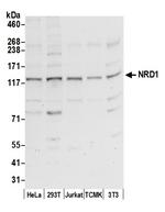 NRD1/Nardilysin Polyclonal Antibody