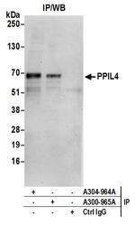 PPIL4 Antibody in Immunoprecipitation (IP)