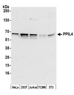 PPIL4 Polyclonal Antibody