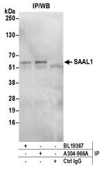 SAAL1 Antibody in Immunoprecipitation (IP)