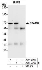 SPATS2/SPATA10 Antibody in Immunoprecipitation (IP)
