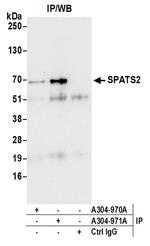 SPATS2/SPATA10 Antibody in Immunoprecipitation (IP)