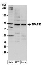 SPATS2/SPATA10 Polyclonal Antibody