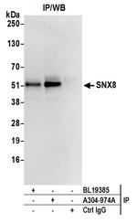 SNX8 Antibody in Immunoprecipitation (IP)