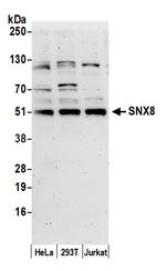 SNX8 Antibody in Western Blot (WB)