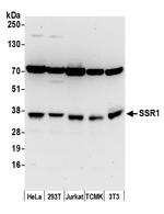 SSR1/TRAP alpha Polyclonal Antibody