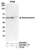 Nucleoredoxin/NXN Polyclonal Antibody