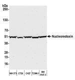 Nucleoredoxin/NXN Antibody in Western Blot (WB)