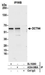 DCTN4/Dynactin p62 Antibody in Immunoprecipitation (IP)
