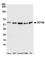 DCTN4/Dynactin p62 Polyclonal Antibody