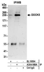 DOCK5 Antibody in Immunoprecipitation (IP)