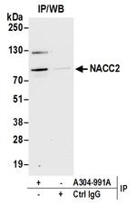 NACC2/BTBD14A Antibody in Immunoprecipitation (IP)