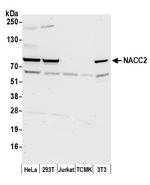 NACC2/BTBD14A Polyclonal Antibody